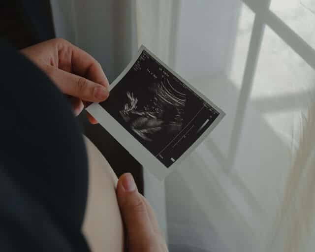 Adoptiert - Schwangere Frau hält Ultraschallbild in Hand