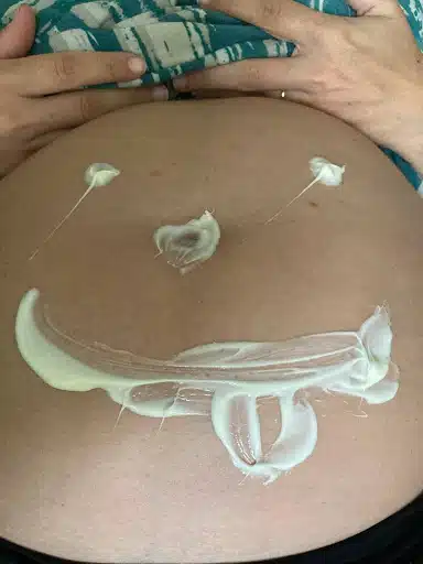 roum-skincare-organic-skin-healing-creme-auf-schwangerem-bauch