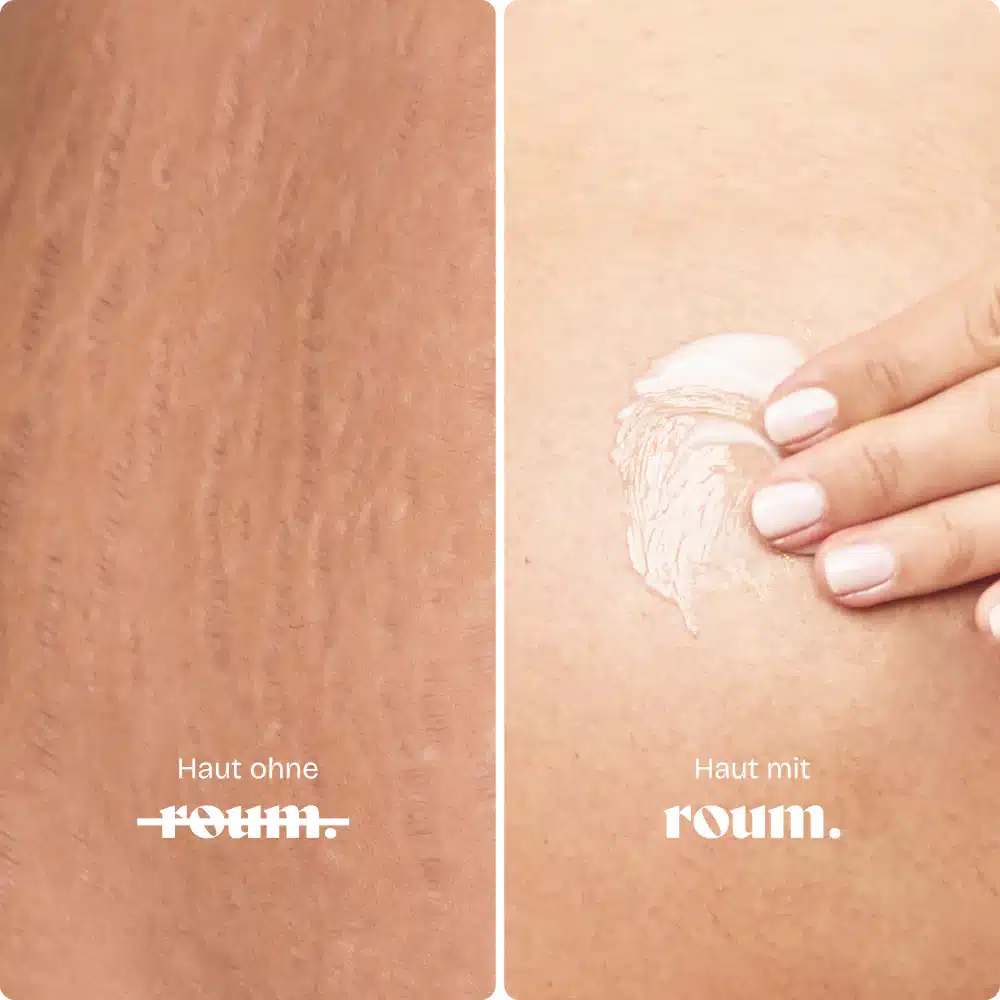 roum-skincare_bellymask-feuchtigkeit-hautvergleich
